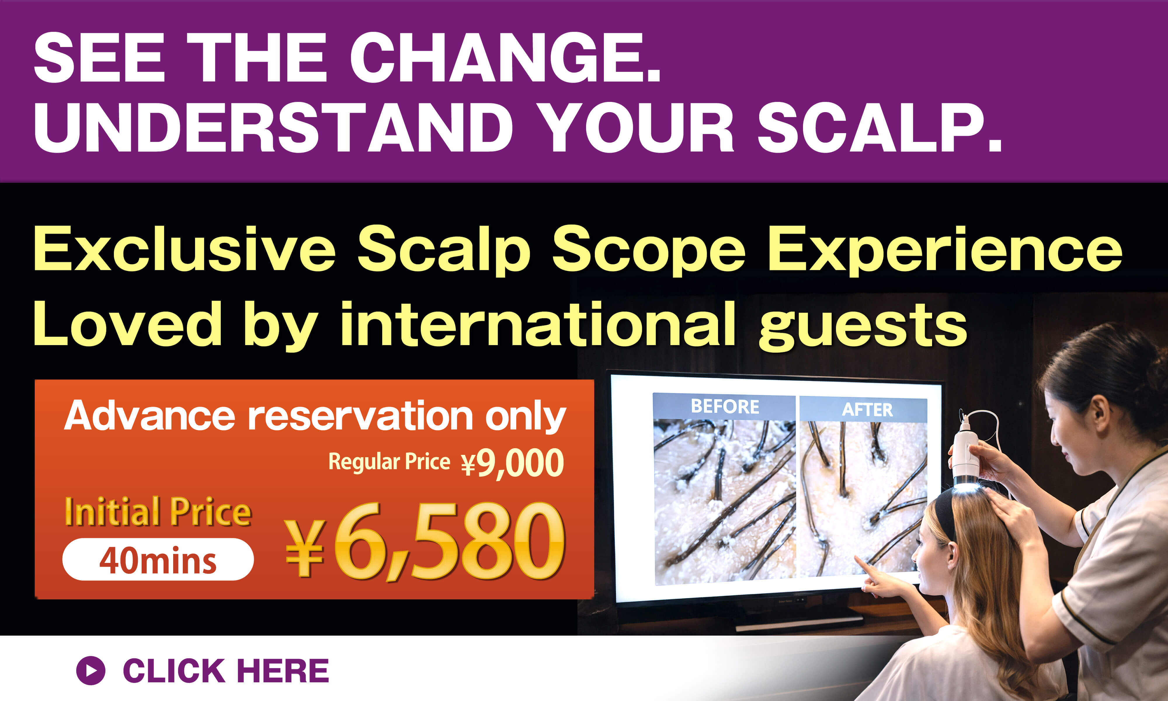 Exclusive Scalp Scope Experience Loved by international guests Advance reservation only　￥6,580