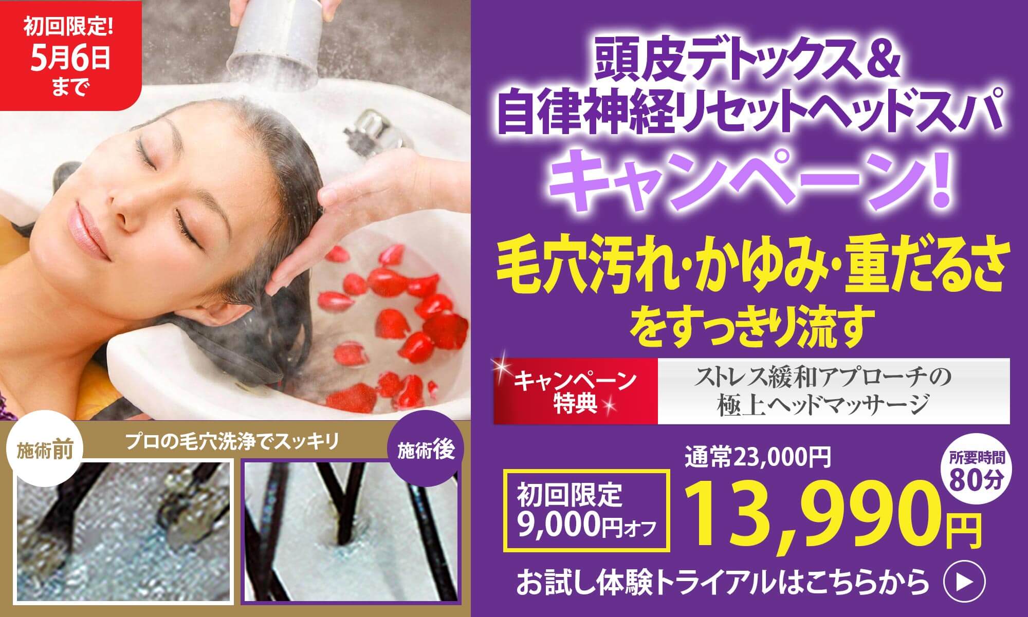 キャンペーン